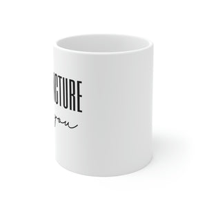 Acupuncture for You Mug